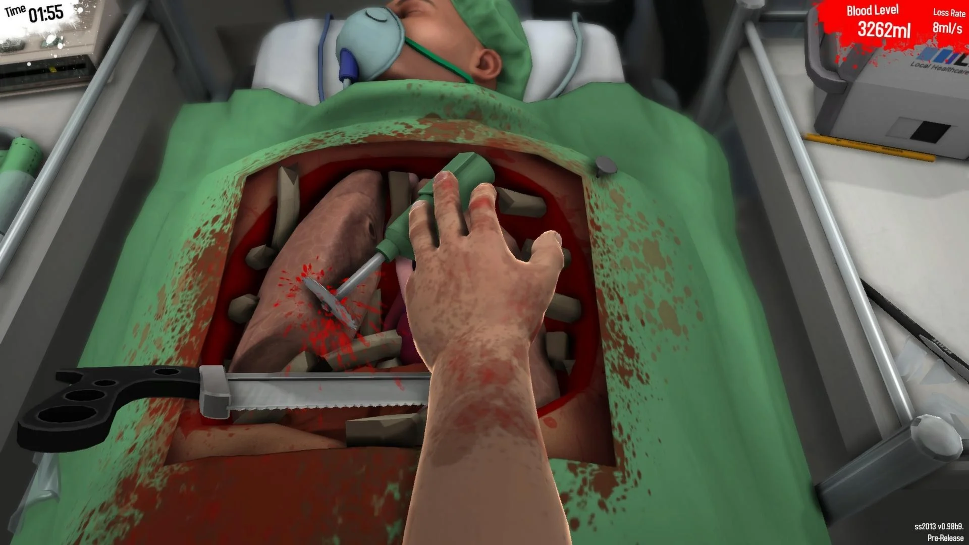 Surgeon Simulator Anniversary Edition